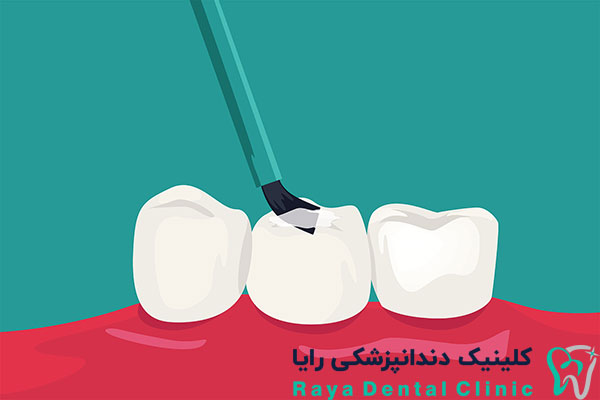 دندان پزشکی ترمیمی