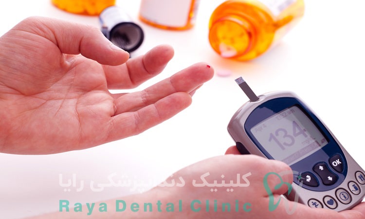 ایمپلنت دندان برای بیماران دیابتی