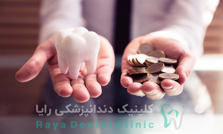قیمت ایمپلنت دندان