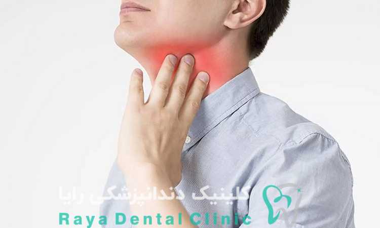 گلو درد پس از ایمپلنت دندان