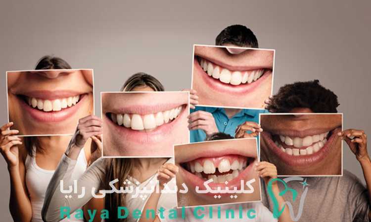 متخصص طرح لبخند
