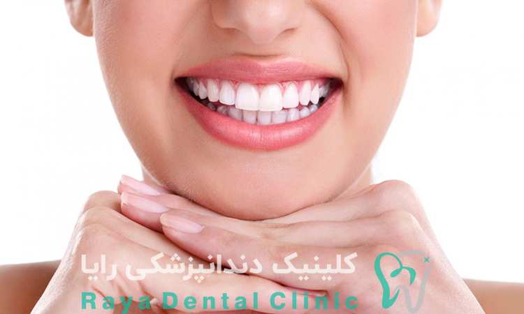 دندانپزشکی زیبایی برای طرح لبخند
