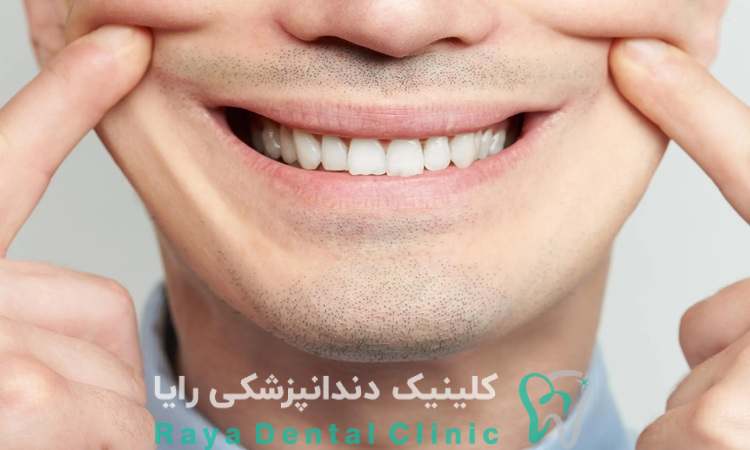 طراحی لبخند مصنوعی