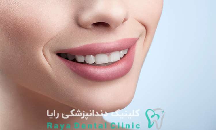 طراحی لبخند