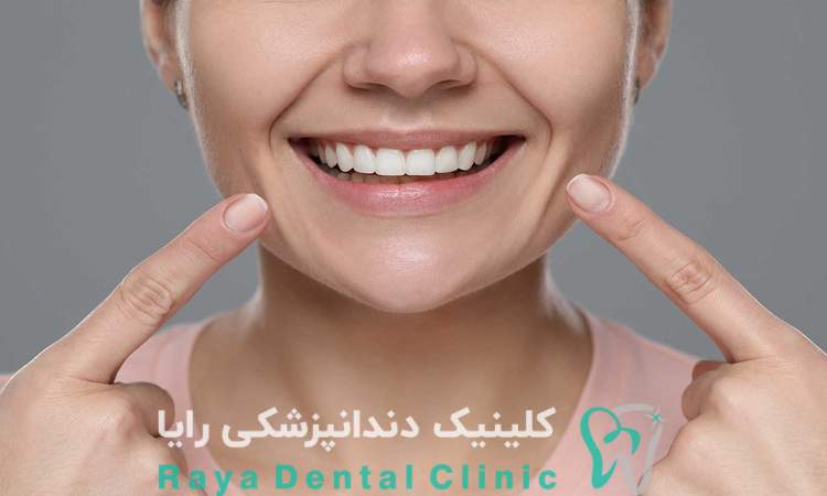 اصلاح طرح لبخند