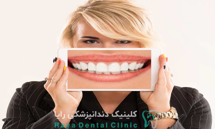 هزینه طراحی لبخند