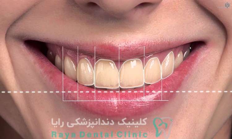 طراحی لبخند دیجیتال